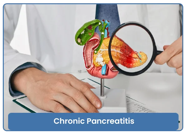 Chronic Pancreatitis