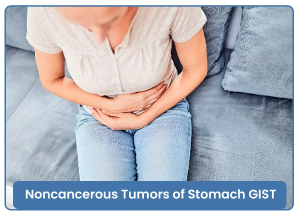 Non-Cancerous Tumors of Stomach (GIST)