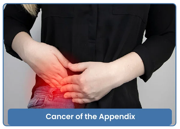 Cancer of the Appendix
