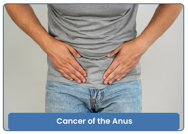 Cancer of the Anus