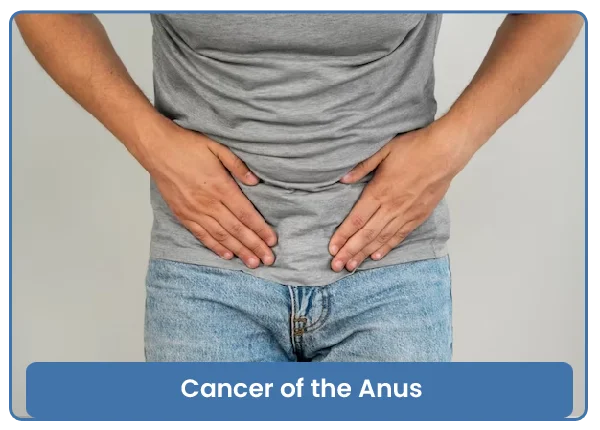 Cancer of the Anus