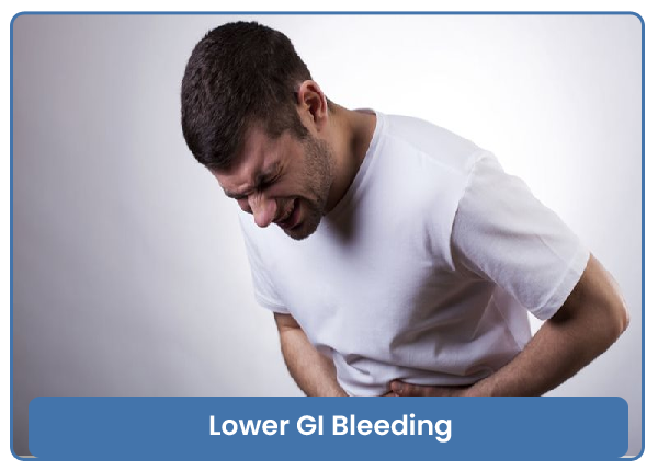 Lower GI Bleeding