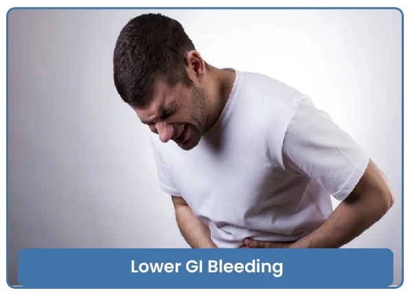 Lower GI Bleeding