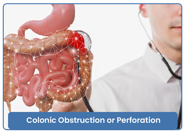 Colonic Obstruction or Perforation