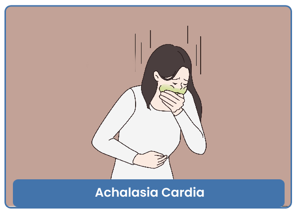 Achalasia Cardia