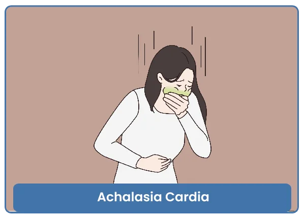 Achalasia Cardia