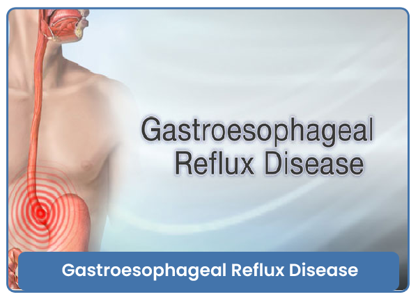 Gastroesophageal Reflux Disease