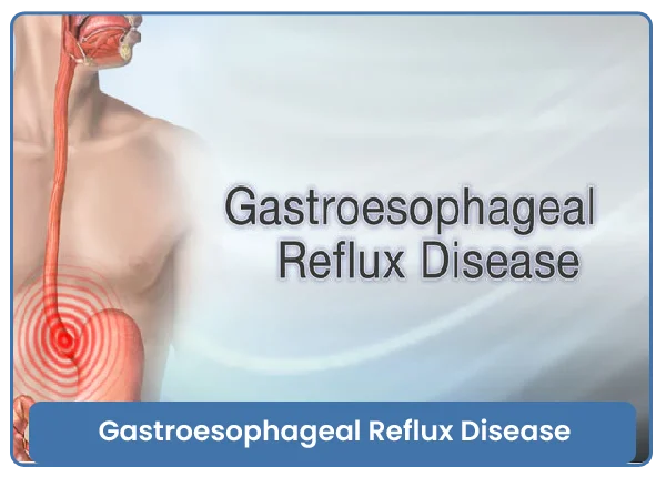Gastroesophageal Reflux Disease