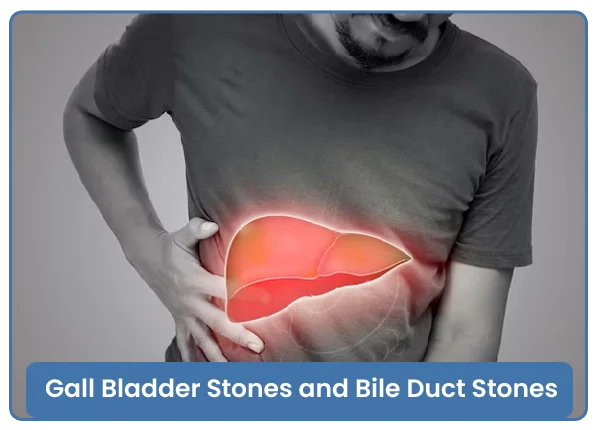 Gall Bladder and Biliary Tree