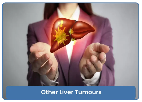 Tumors Of Liver