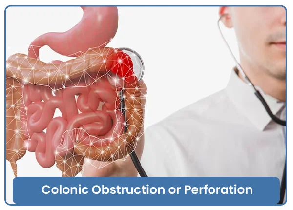 Other Diseases Of The Colon (Large Intestine) & Small Intestine