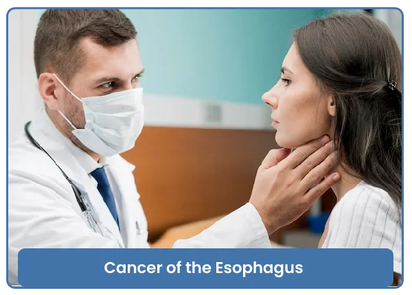 Esophagus Treatment